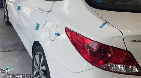 هیوندای اکسنت (مونتاژ)‏ | 1397